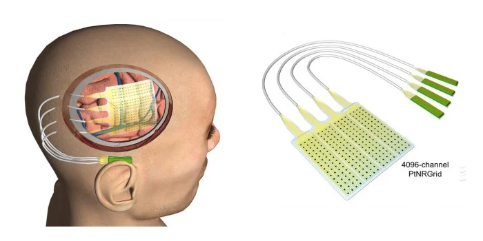 網(wǎng)格密密麻麻